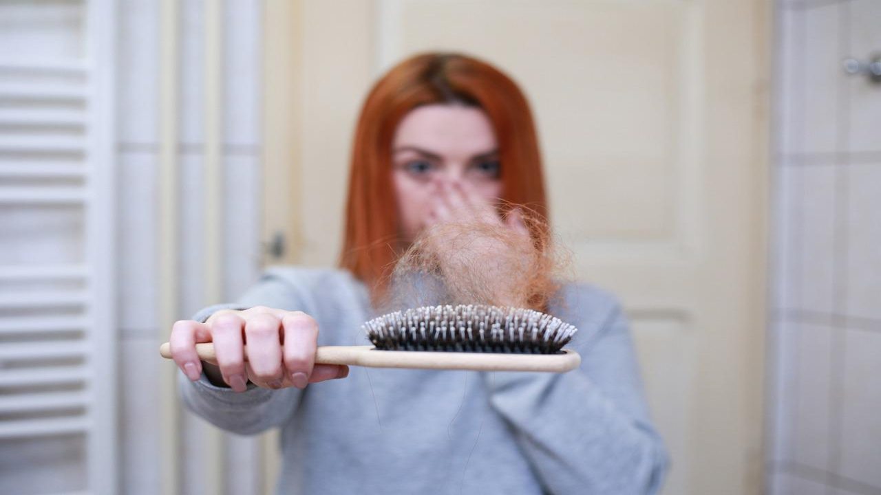 Trapianto di capelli, tutto ciò che c'è da sapere prima di farlo- curiosauro.it- 170522