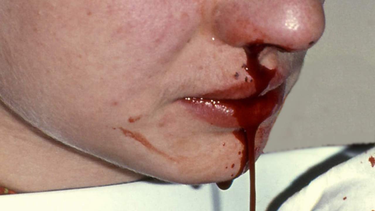 Sangue dal naso - www.curiosauro.it