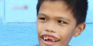 Denti