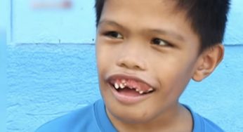 Ha nella sua bocca più di 300 denti ma non è uno squalo: sogna di diventare ingegnere