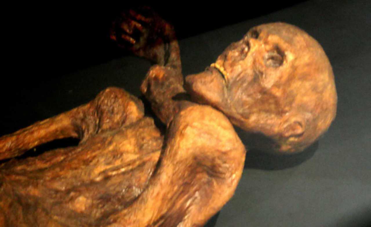 Ötzi