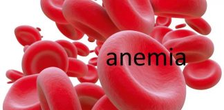 Anemia