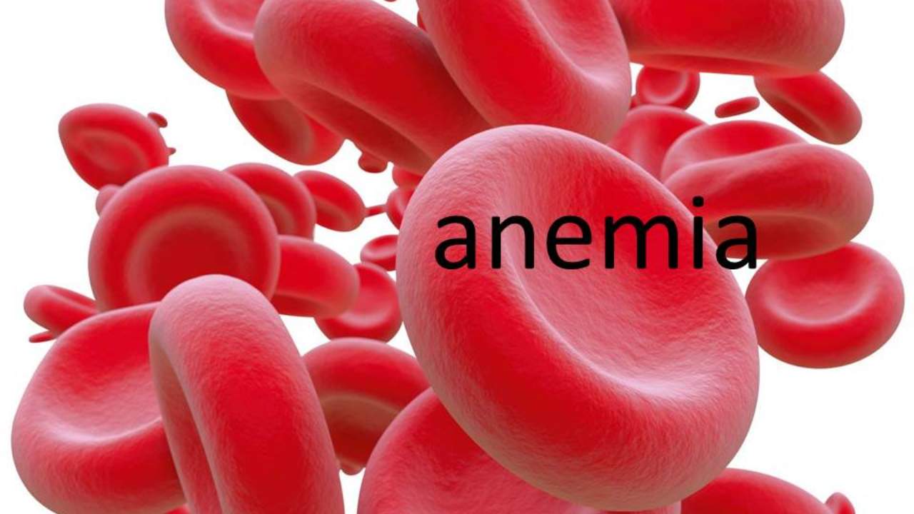 Anemia