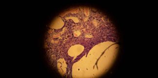 cellule pelle