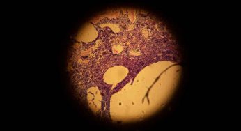 Medicina rigenerativa | Cellule della pelle umana ringiovanite di 30 anni