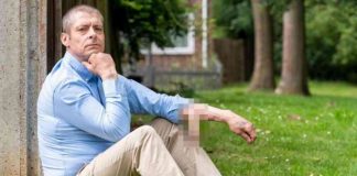 Malcolm MacDonald-L'uomo con il pene sul braccio (captured) - www.curiosauro.it