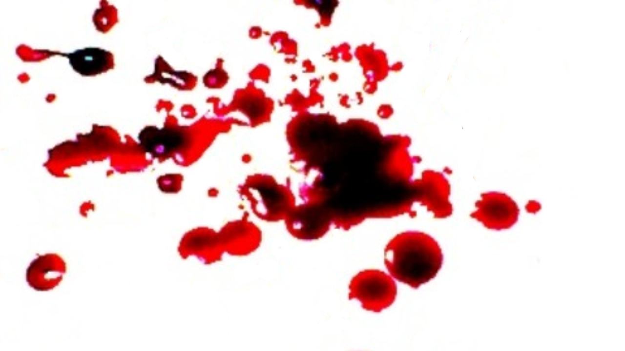 Sangue - www.curiosauro.it
