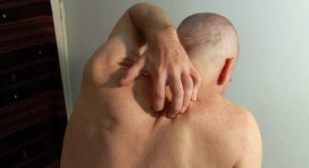 Prurito da morire | Scoperta la proteina che ci obbliga a grattarci