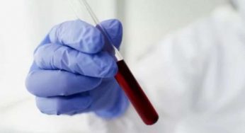 VES | Cause e sintomi di valori troppo alti nelle analisi del sangue
