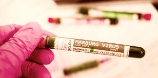 virus Marburg - www.curiosauro.it
