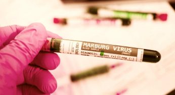 Più spaventoso dell’Ebola: paura per la diffusione del virus Marburg | Sintomi e mortalità﻿