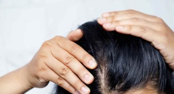 Orrore forfora sui capelli: il rimedio portentoso è a costo 0