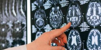 Covid: gravi effetti sugli adolescenti